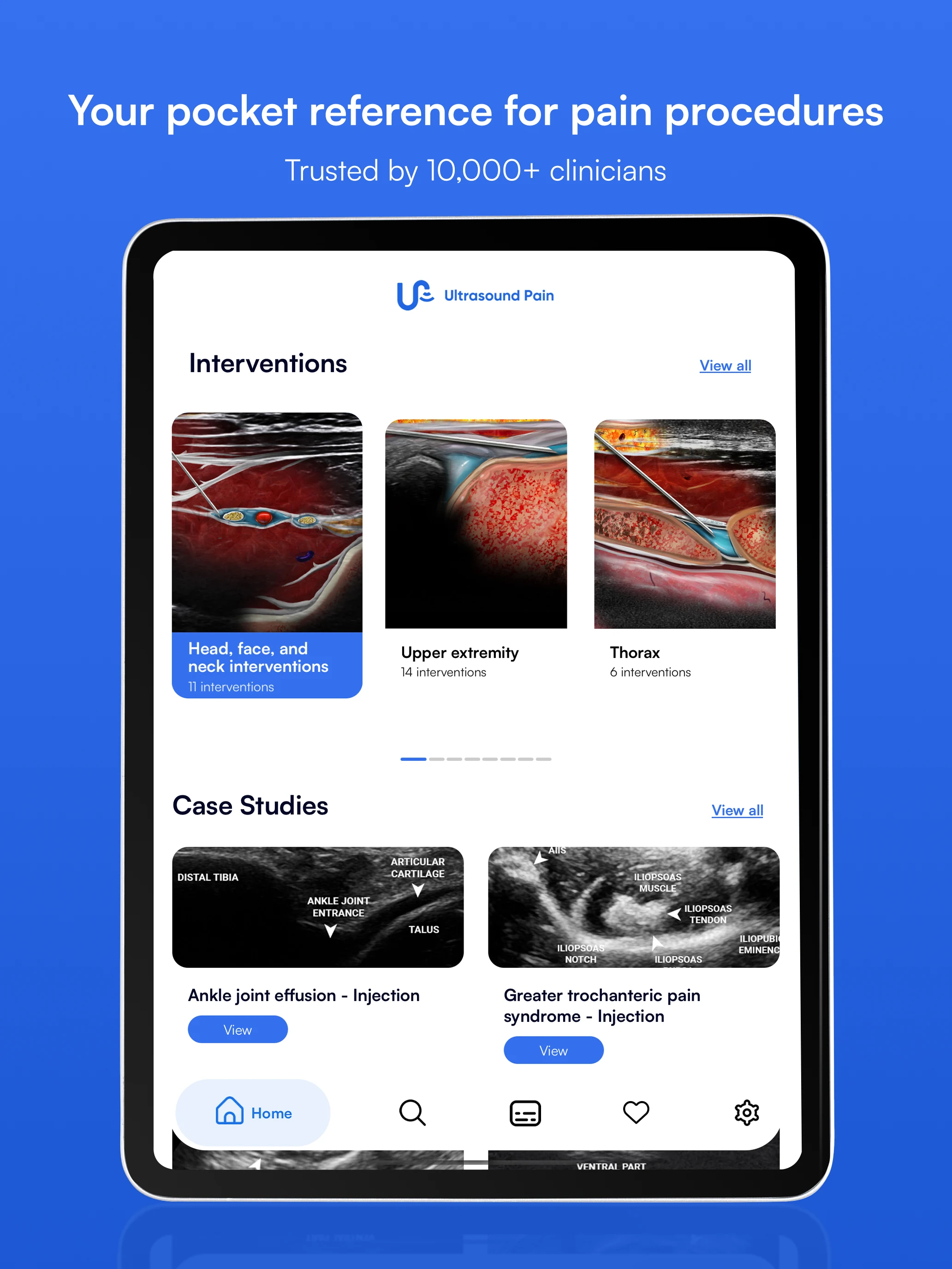 Ultrasound Pain screenshot