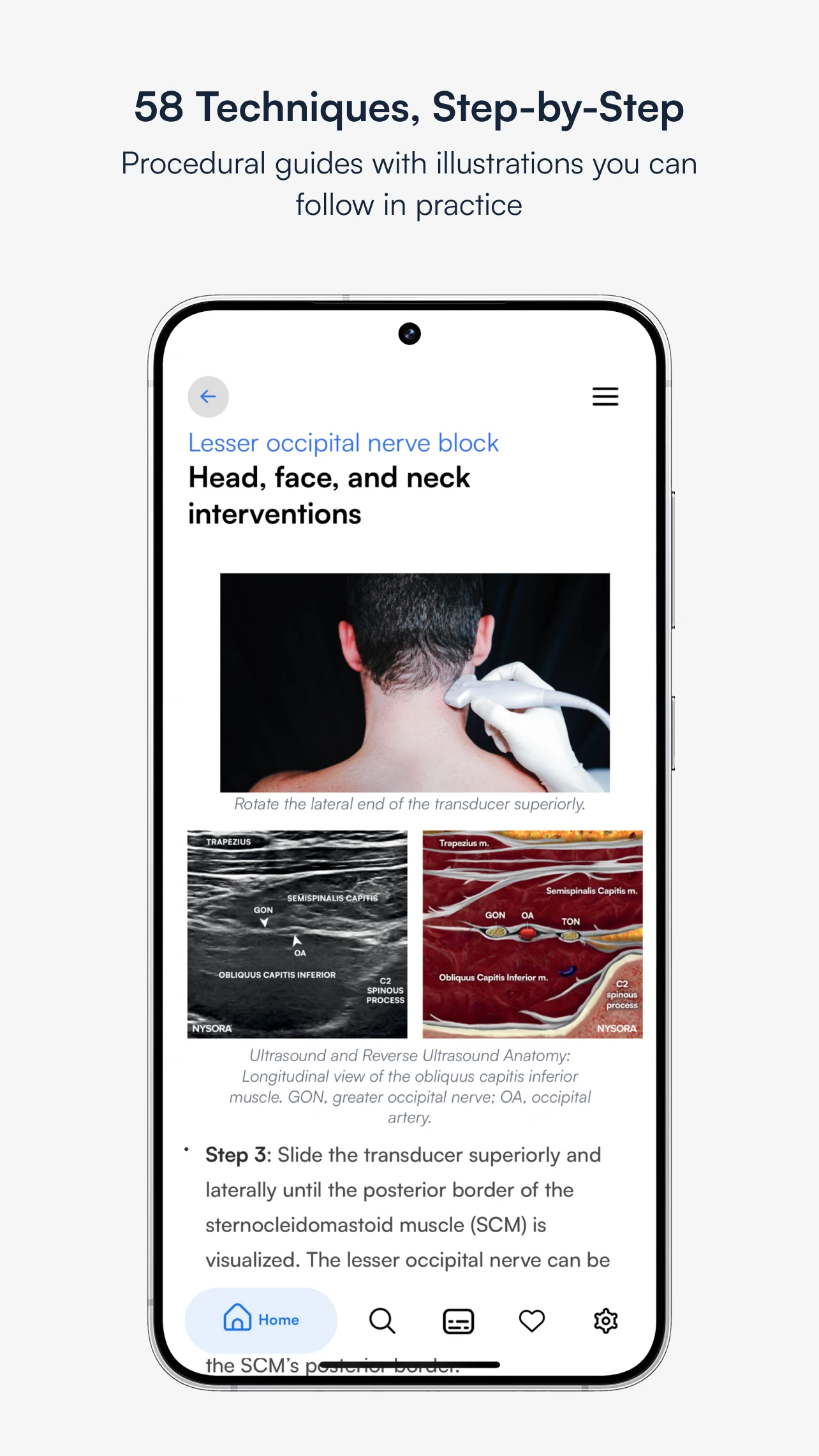 Ultrasound Pain screenshot